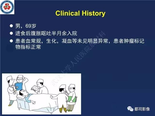 【PPT】十二指肠异位胰腺影像诊断