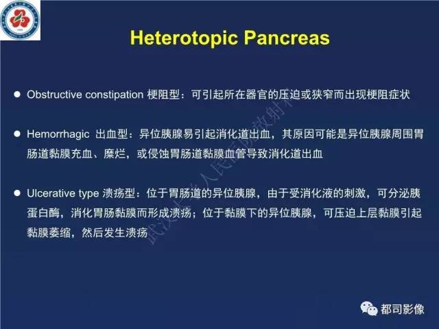 【PPT】十二指肠异位胰腺影像诊断