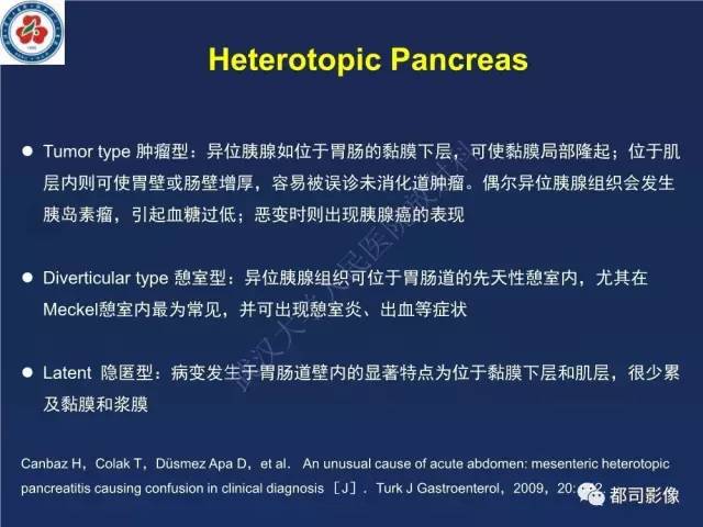 【PPT】十二指肠异位胰腺影像诊断