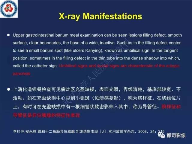 【PPT】十二指肠异位胰腺影像诊断
