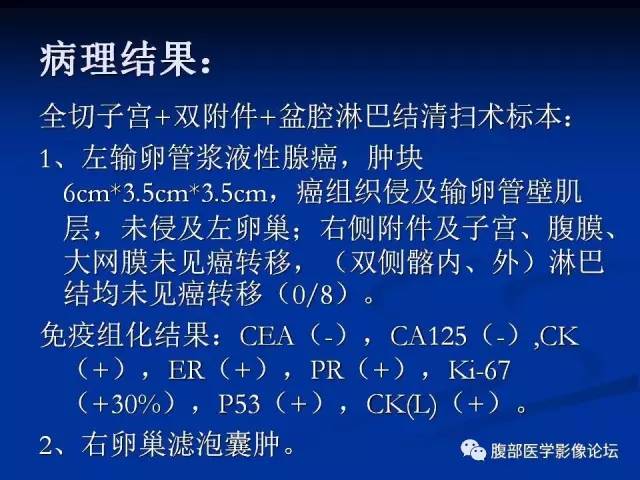 【病例】左输卵管浆液性腺癌1例MR 【病例】左输卵管浆液性腺癌1例MR