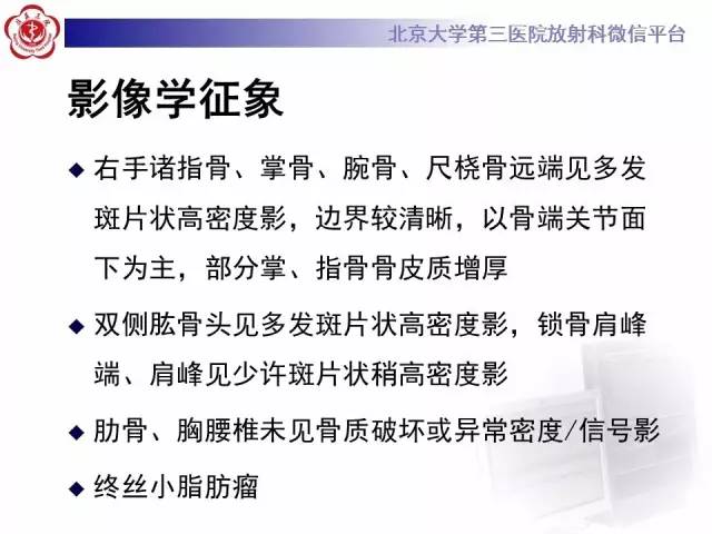【病例】骨斑点症1例X线MR影像表现