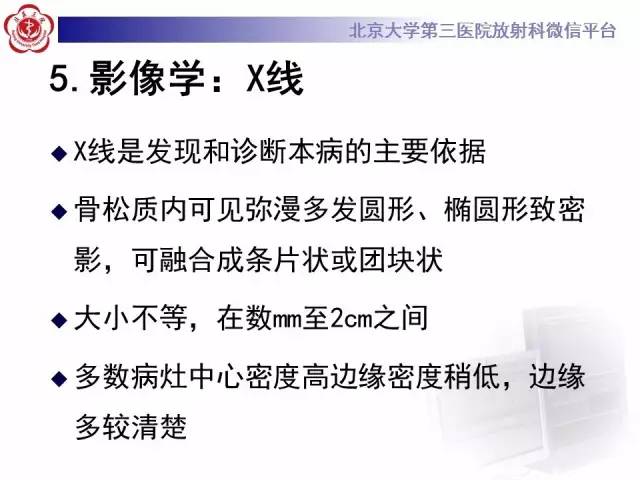 【病例】骨斑点症1例X线MR影像表现