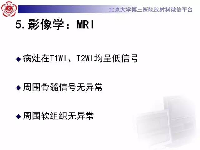 【病例】骨斑点症1例X线MR影像表现