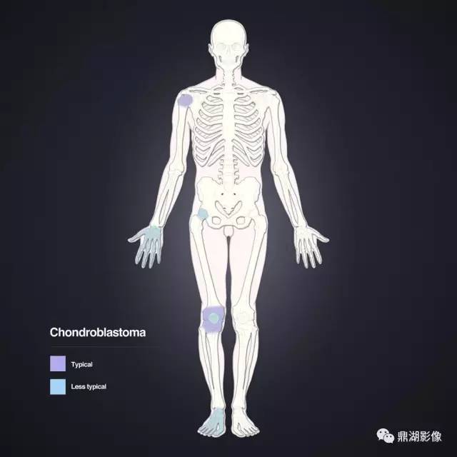六种长管状骨干骺端常见良性疾病
