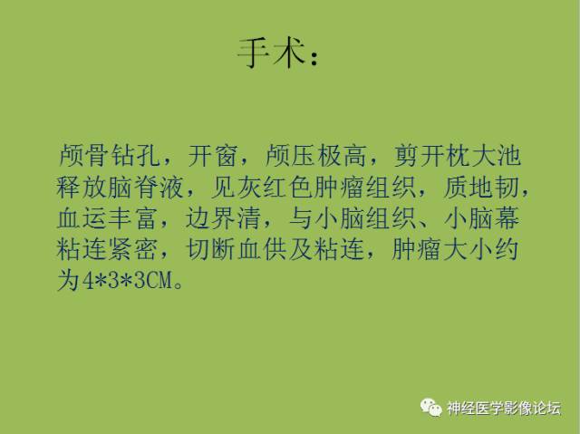 【病例】小脑纤维型脑膜瘤一例MR影像表现