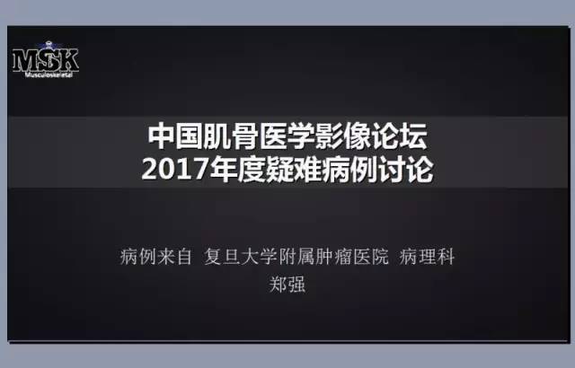 【病例】胫骨上皮样血管内皮瘤1例X线CT 【病例】胫骨上皮样血管内皮瘤1例X线CT