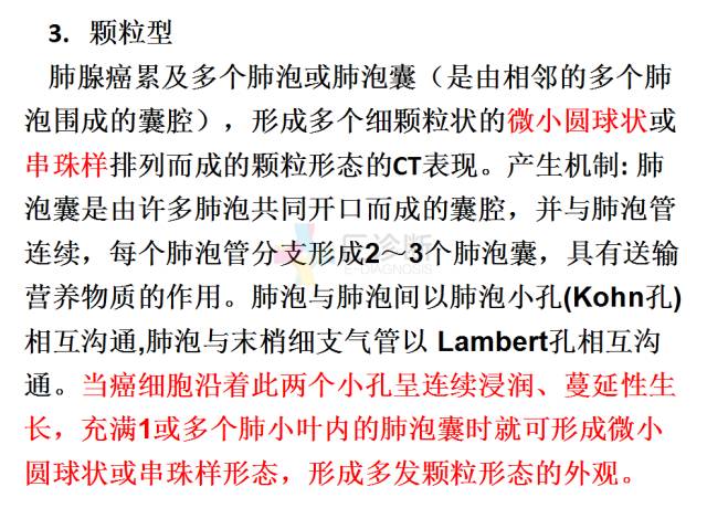 【PPT】微小肺癌的CT形态学分型