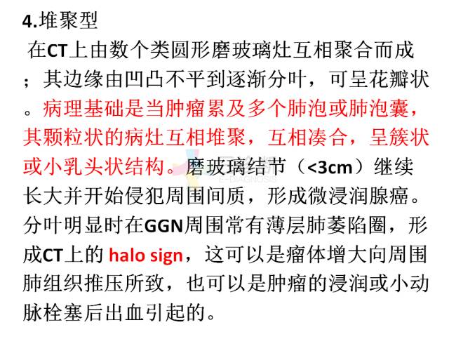 【PPT】微小肺癌的CT形态学分型