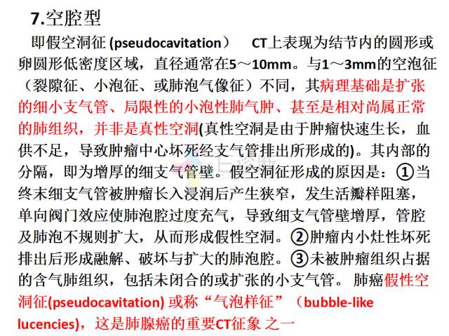 【PPT】微小肺癌的CT形态学分型