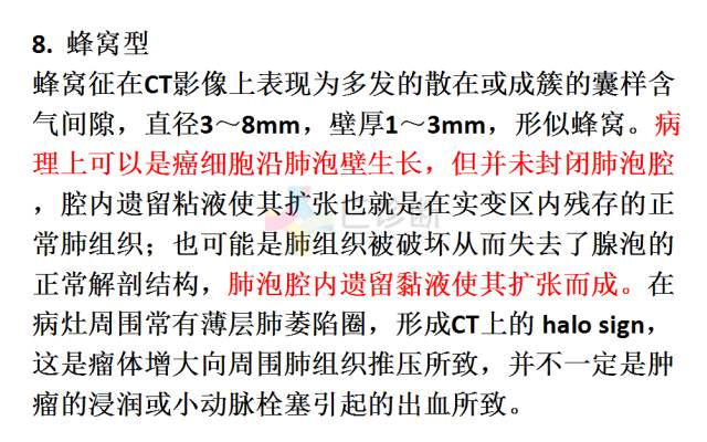 【PPT】微小肺癌的CT形态学分型