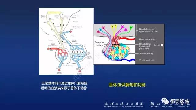 【PPT】侵袭性垂体瘤MRI与临床