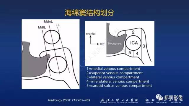 【PPT】侵袭性垂体瘤MRI与临床