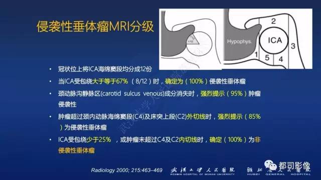 【PPT】侵袭性垂体瘤MRI与临床