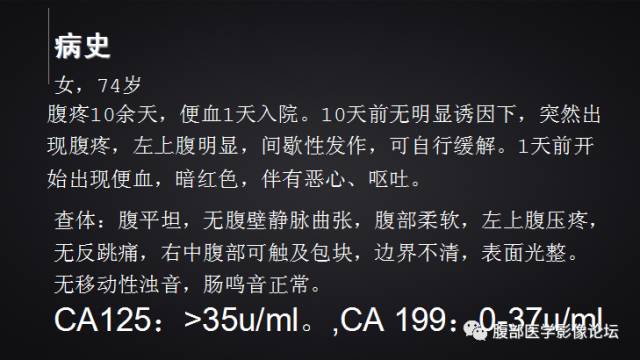 【病例】回盲部淋巴瘤一例CT