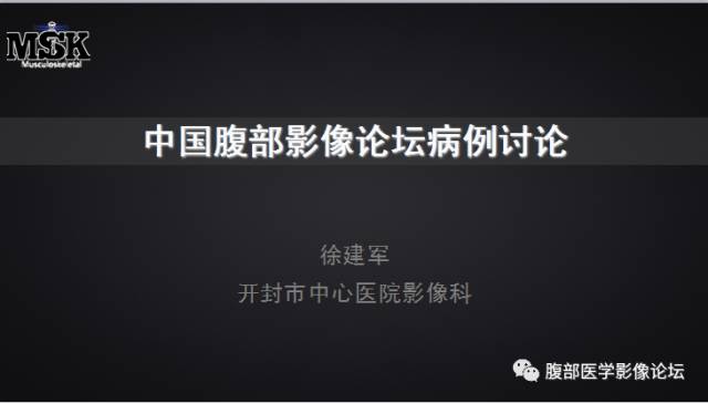 【病例】回盲部淋巴瘤一例CT 【病例】回盲部淋巴瘤一例CT