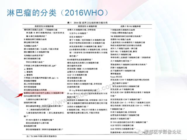 【PPT】粘膜相关淋巴组织淋巴瘤