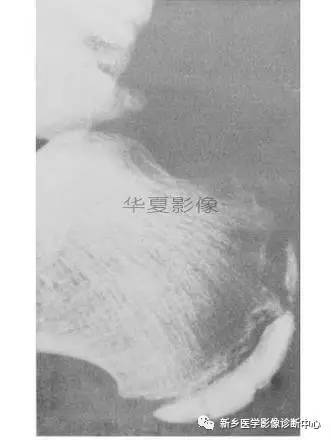 下肢骨，你应该想到的48种变异