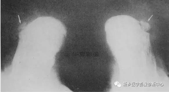 下肢骨，你应该想到的48种变异