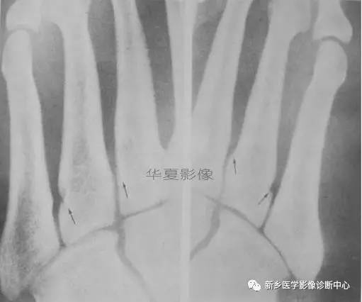 下肢骨，你应该想到的48种变异