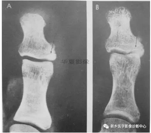 下肢骨,你应该想到的48种变异 下肢骨,你应该想到的48种变异