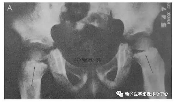 下肢骨，你应该想到的48种变异