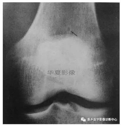 下肢骨，你应该想到的48种变异