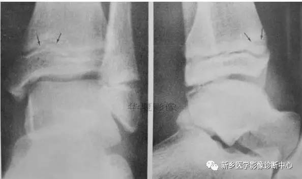 下肢骨，你应该想到的48种变异