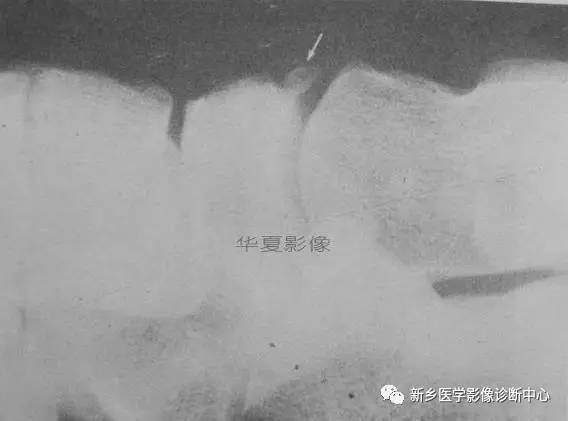 下肢骨,你应该想到的48种变异 下肢骨,你应该想到的48种变异