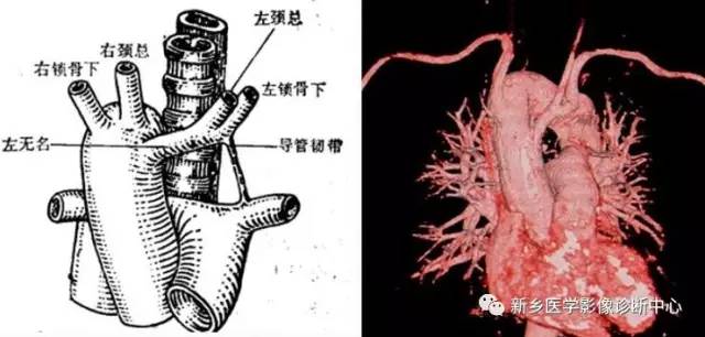 11种主动脉弓部畸形，您都了解吗？