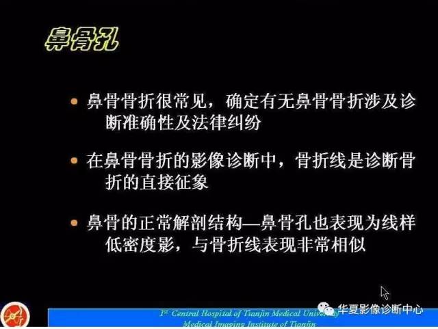 【PPT】鼻骨孔-鼻骨骨折诊断的误区