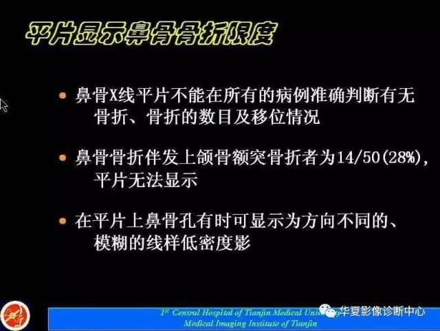【PPT】鼻骨孔-鼻骨骨折诊断的误区