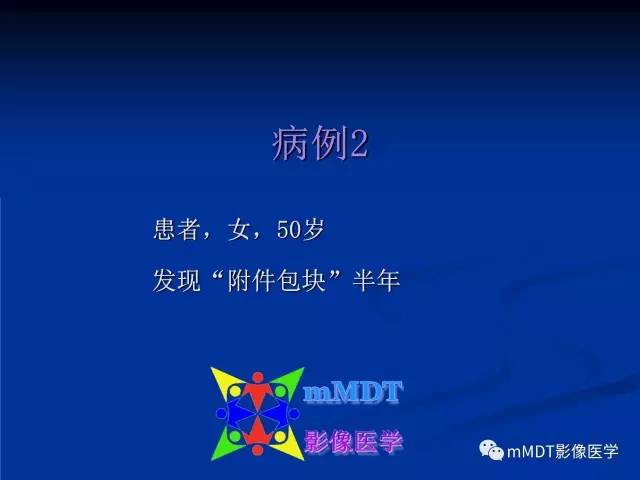 【PPT】女性附件扭转MRI的表现
