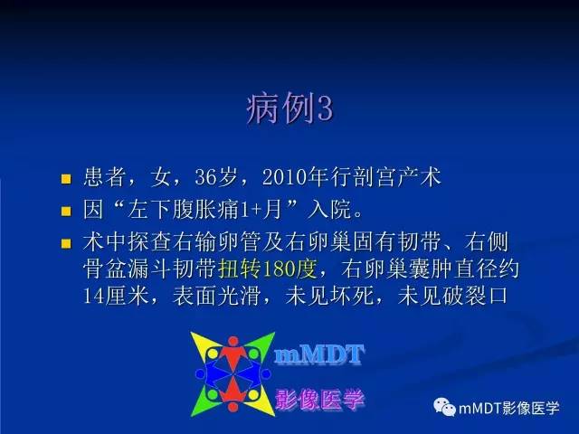 【PPT】女性附件扭转MRI的表现