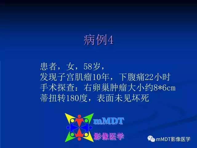 【PPT】女性附件扭转MRI的表现