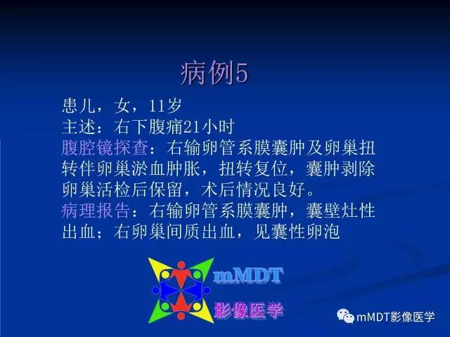 【PPT】女性附件扭转MRI的表现