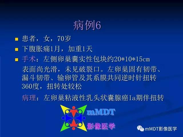 【PPT】女性附件扭转MRI的表现