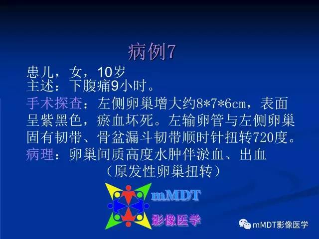 【PPT】女性附件扭转MRI的表现
