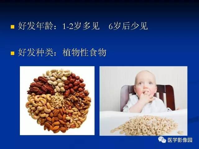 【PPT】儿童气管及支气管非金属异物影像学评价