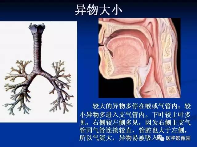 【PPT】儿童气管及支气管非金属异物影像学评价