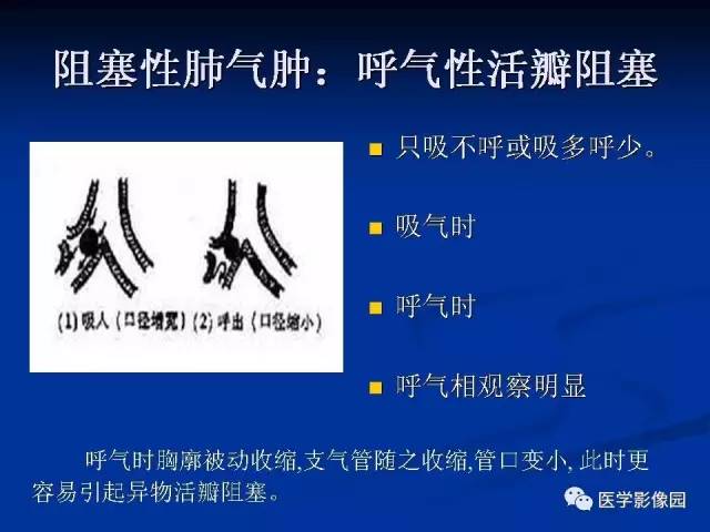 【PPT】儿童气管及支气管非金属异物影像学评价