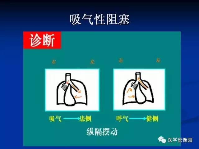 【PPT】儿童气管及支气管非金属异物影像学评价