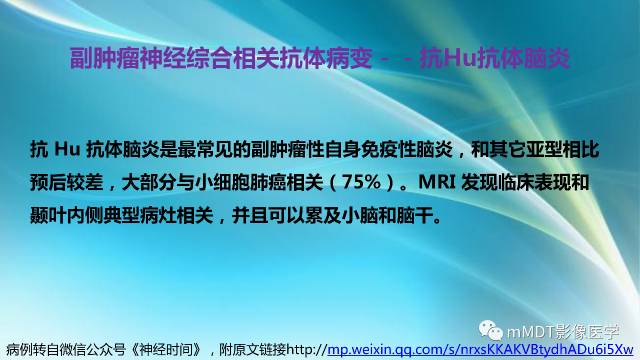 【PPT】副肿瘤神经综合征：小脑变性