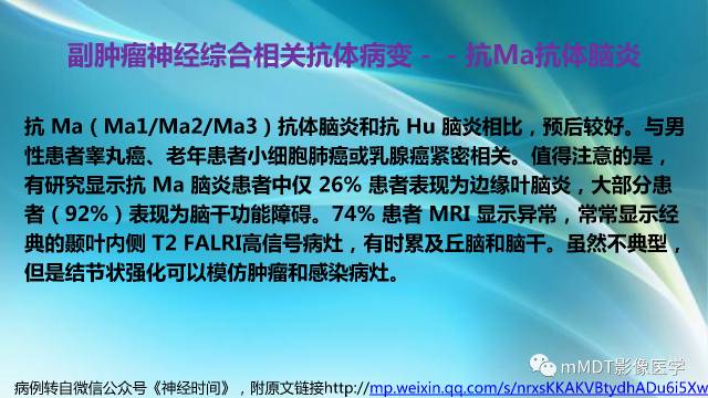【PPT】副肿瘤神经综合征：小脑变性