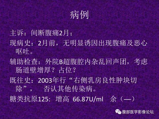 【病例】小肠间质瘤1例CT