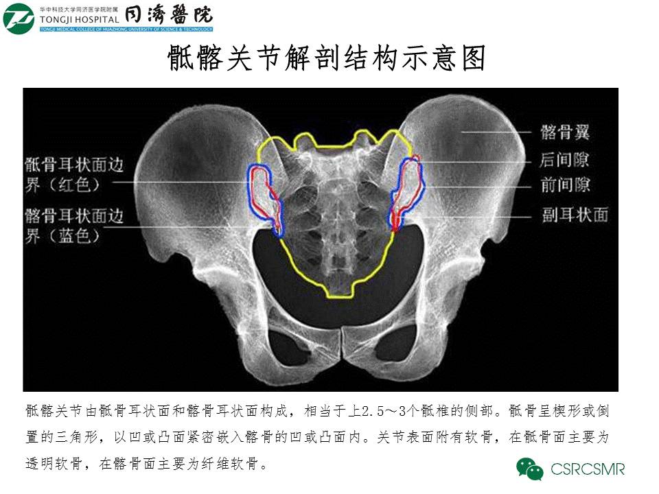 【PPT】各种影像技术对诊断骶髂关节炎的价值