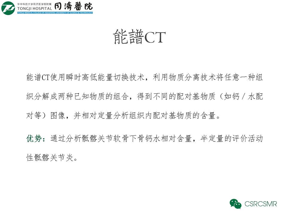 【PPT】各种影像技术对诊断骶髂关节炎的价值