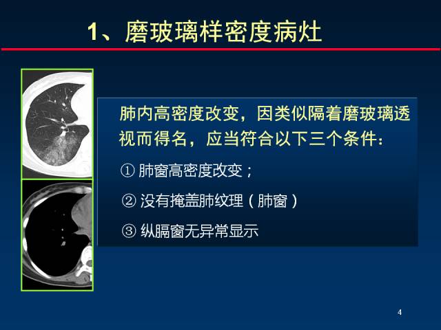【PPT】肺实质与支气管——基本CT征象的定义与诠释