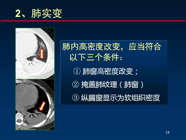 【PPT】肺实质与支气管——基本CT征象的定义与诠释