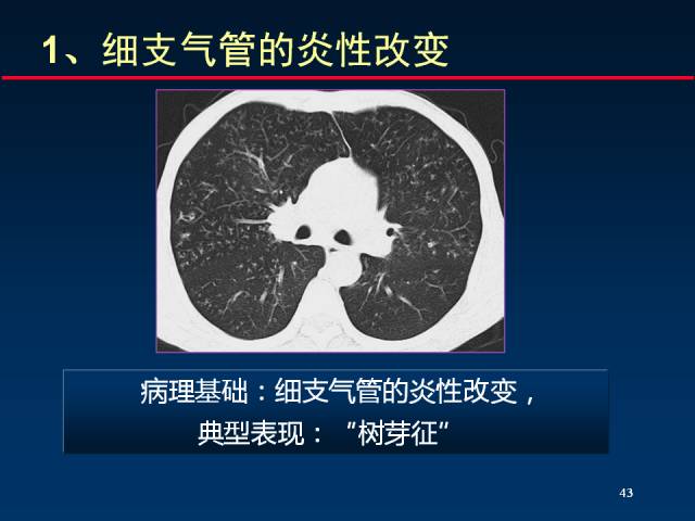 【PPT】肺实质与支气管——基本CT征象的定义与诠释